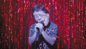 A man with neurofibromatosis sings onstage against a sparkly red curtain.