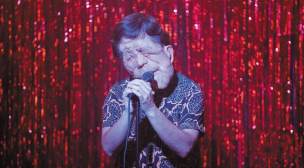 A man with neurofibromatosis sings onstage against a sparkly red curtain.