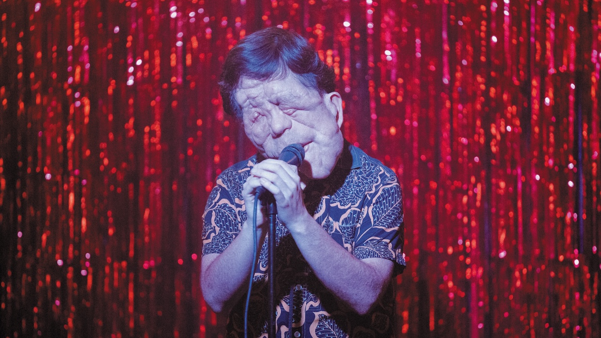 A man with neurofibromatosis sings onstage against a sparkly red curtain.